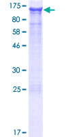 ASAP3 Protein - 12.5% SDS-PAGE of human DDEFL1 stained with Coomassie Blue