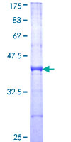 ASB10 Protein - 12.5% SDS-PAGE Stained with Coomassie Blue.
