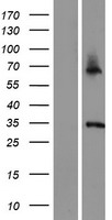 ASB11 Protein - Western validation with an anti-DDK antibody * L: Control HEK293 lysate R: Over-expression lysate