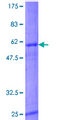 ASB11 Protein - 12.5% SDS-PAGE of human ASB11 stained with Coomassie Blue