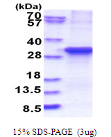 ASB13 Protein