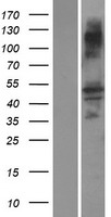 ASB16 Protein - Western validation with an anti-DDK antibody * L: Control HEK293 lysate R: Over-expression lysate
