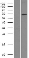 ASB2 Protein - Western validation with an anti-DDK antibody * L: Control HEK293 lysate R: Over-expression lysate