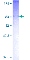 ASB2 Protein - 12.5% SDS-PAGE of human ASB2 stained with Coomassie Blue