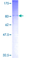 ASB2 Protein - 12.5% SDS-PAGE of human ASB2 stained with Coomassie Blue