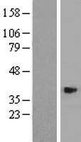 ASB4 Protein - Western validation with an anti-DDK antibody * L: Control HEK293 lysate R: Over-expression lysate