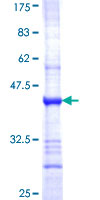 ASB4 Protein - 12.5% SDS-PAGE Stained with Coomassie Blue.