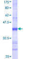 ASB5 Protein - 12.5% SDS-PAGE Stained with Coomassie Blue.