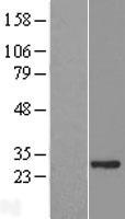 ASB7 Protein - Western validation with an anti-DDK antibody * L: Control HEK293 lysate R: Over-expression lysate