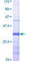 ASB7 Protein - 12.5% SDS-PAGE Stained with Coomassie Blue.