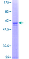 ASB8 Protein - 12.5% SDS-PAGE of human ASB8 stained with Coomassie Blue