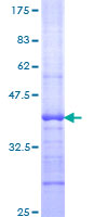 ASB8 Protein - 12.5% SDS-PAGE Stained with Coomassie Blue.