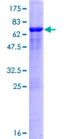 ASCC1 Protein - 12.5% SDS-PAGE of human ASCC1 stained with Coomassie Blue