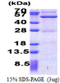 ASCC1 Protein