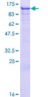 ASCC2 Protein - 12.5% SDS-PAGE of human ASCC2 stained with Coomassie Blue