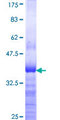 ASCC2 Protein - 12.5% SDS-PAGE Stained with Coomassie Blue.
