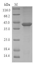 ASCC3 Protein - (Tris-Glycine gel) Discontinuous SDS-PAGE (reduced) with 5% enrichment gel and 15% separation gel.
