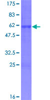 ASCL1 / MASH1 Protein - 12.5% SDS-PAGE of human ASCL1 stained with Coomassie Blue