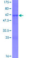 ASCL1 / MASH1 Protein - 12.5% SDS-PAGE of human ASCL1 stained with Coomassie Blue