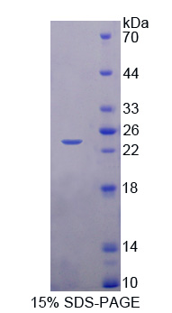ASCL1 / MASH1 Protein - Recombinant  Achaete Scute Complex Like Protein 1 By SDS-PAGE