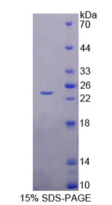 ASCL1 / MASH1 Protein - Recombinant  Achaete Scute Complex Like Protein 1 By SDS-PAGE