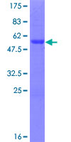 ASCL2 Protein - 12.5% SDS-PAGE of human ASCL2 stained with Coomassie Blue