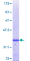 ASCL3 Protein - 12.5% SDS-PAGE Stained with Coomassie Blue.