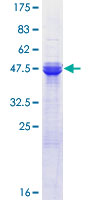 ASF1A Protein - 12.5% SDS-PAGE of human ASF1A stained with Coomassie Blue