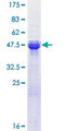 ASF1A Protein - 12.5% SDS-PAGE of human ASF1A stained with Coomassie Blue