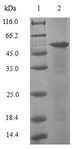 ASF1A Protein - (Tris-Glycine gel) Discontinuous SDS-PAGE (reduced) with 5% enrichment gel and 15% separation gel.