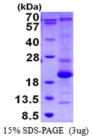 ASF1B Protein