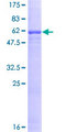 ASGR1 / ASGPR Protein - 12.5% SDS-PAGE of human ASGR1 stained with Coomassie Blue