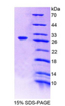 ASGR1 / ASGPR Protein