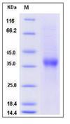 ASGR1 / ASGPR Protein