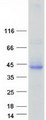 ASGR1 / ASGPR Protein - Purified recombinant protein ASGR1 was analyzed by SDS-PAGE gel and Coomassie Blue Staining
