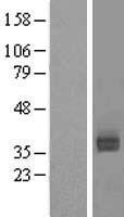 ASGR2 Protein - Western validation with an anti-DDK antibody * L: Control HEK293 lysate R: Over-expression lysate