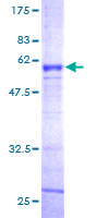 ASGR2 Protein - 12.5% SDS-PAGE of human ASGR2 stained with Coomassie Blue