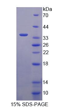 ASGR2 Protein - Recombinant  Asialoglycoprotein Receptor 2 By SDS-PAGE