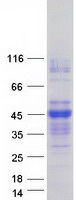 ASGR2 Protein - Purified recombinant protein ASGR2 was analyzed by SDS-PAGE gel and Coomassie Blue Staining