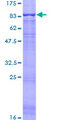 ASIC1 / ACCN2 Protein - 12.5% SDS-PAGE of human ACCN2 stained with Coomassie Blue