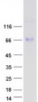 ASIC1 / ACCN2 Protein - Purified recombinant protein ASIC1 was analyzed by SDS-PAGE gel and Coomassie Blue Staining