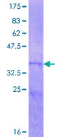 ASIP Protein - 12.5% SDS-PAGE Stained with Coomassie Blue.