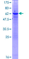 ASMT / HIOMT Protein - 12.5% SDS-PAGE of human ASMT stained with Coomassie Blue