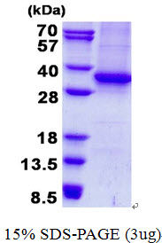 ASMT / HIOMT Protein