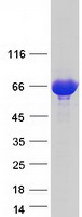 ASMTL Protein - Purified recombinant protein ASMTL was analyzed by SDS-PAGE gel and Coomassie Blue Staining