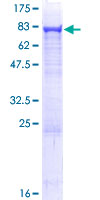 ASNS Protein - 12.5% SDS-PAGE of human ASNS stained with Coomassie Blue