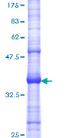 ASNS Protein - 12.5% SDS-PAGE Stained with Coomassie Blue.