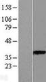 ASPA Protein - Western validation with an anti-DDK antibody * L: Control HEK293 lysate R: Over-expression lysate