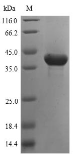 ASPA Protein - (Tris-Glycine gel) Discontinuous SDS-PAGE (reduced) with 5% enrichment gel and 15% separation gel.