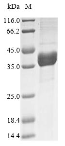 ASPA Protein - (Tris-Glycine gel) Discontinuous SDS-PAGE (reduced) with 5% enrichment gel and 15% separation gel.